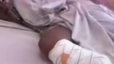 Photo de Il coupe la jambe de sa femme pour une raison banale